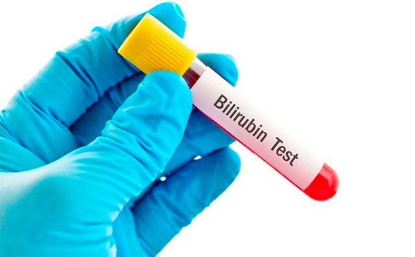 Bilirubin có liên quan đến các bệnh về gan